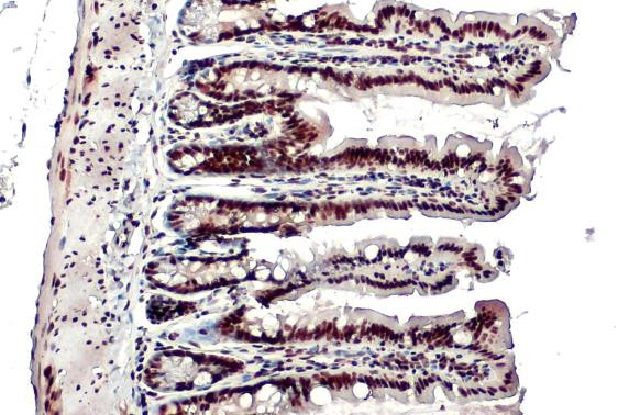 TRIM28 Antibody in Immunohistochemistry (Paraffin) (IHC (P))