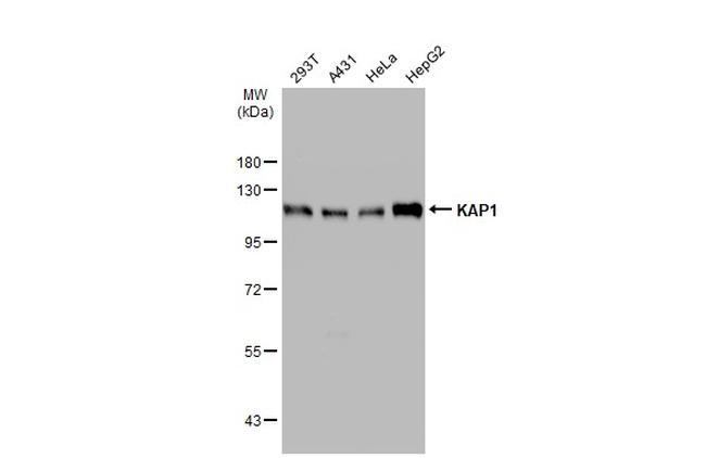 TRIM28 Antibody in Western Blot (WB)