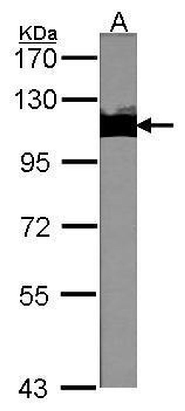 TRIM28 Antibody in Western Blot (WB)