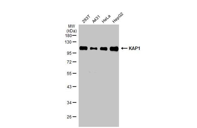 TRIM28 Antibody in Western Blot (WB)