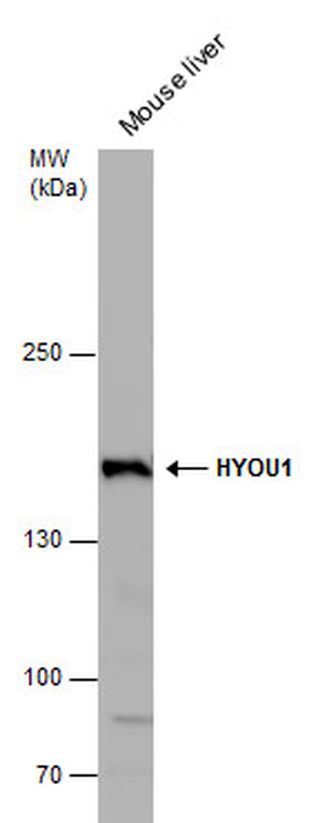 HYOU1 Antibody in Western Blot (WB)