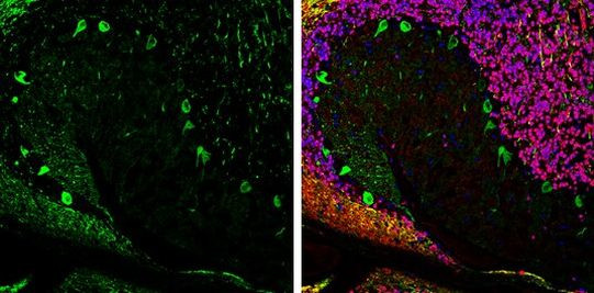 Aldolase C Antibody in Immunohistochemistry (Frozen) (IHC (F))