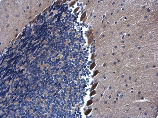 AHA1 Antibody in Immunohistochemistry (Paraffin) (IHC (P))