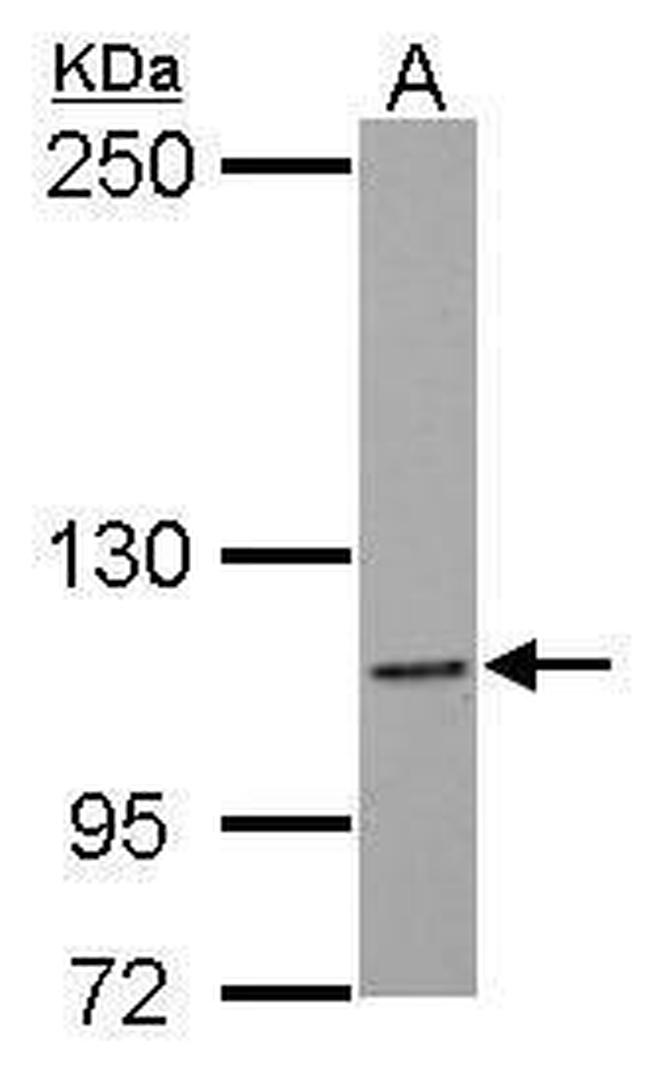NLRC4 Antibody in Western Blot (WB)