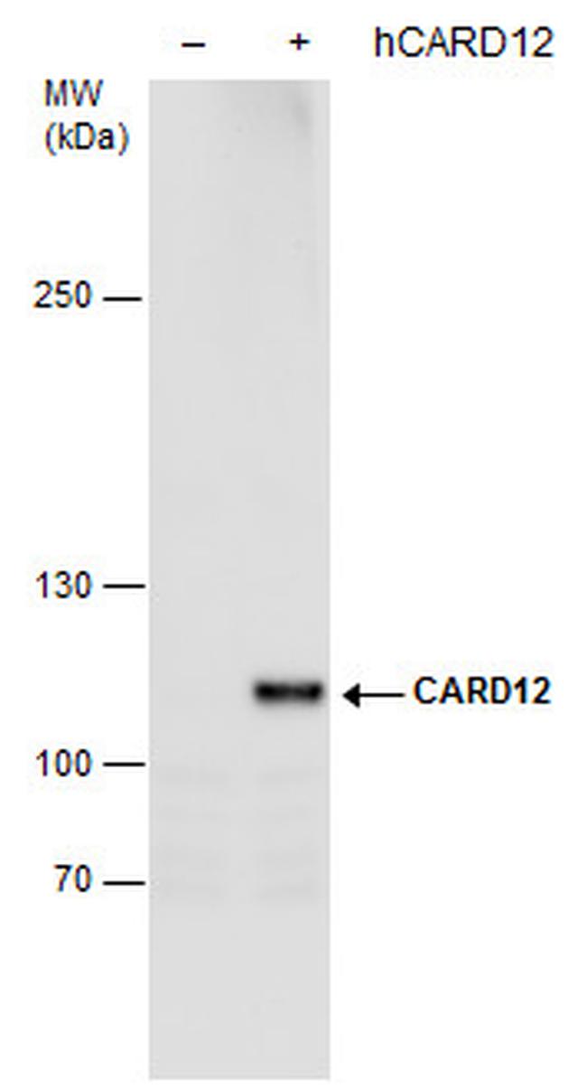 NLRC4 Antibody in Western Blot (WB)