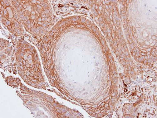 BAG3 Antibody in Immunohistochemistry (Paraffin) (IHC (P))