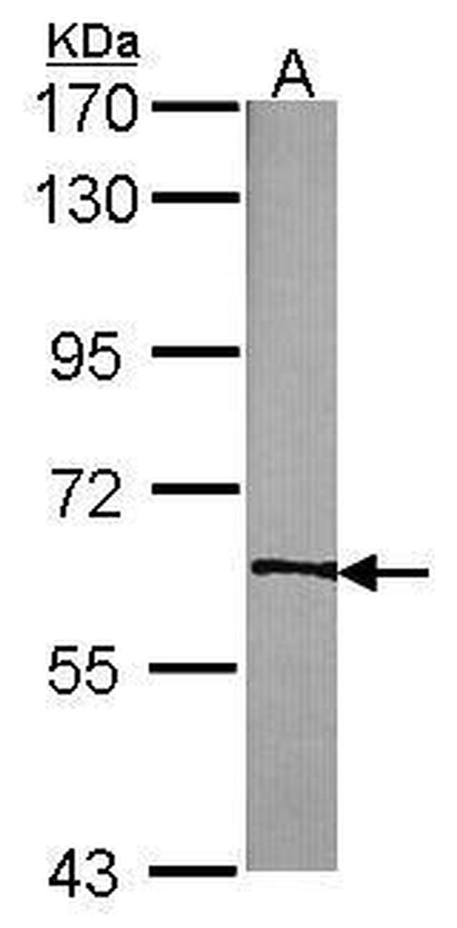 TrkC Antibody in Western Blot (WB)