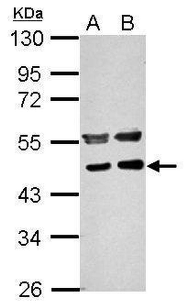 PPME1 Antibody in Western Blot (WB)