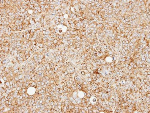 MCCC2 Antibody in Immunohistochemistry (Paraffin) (IHC (P))