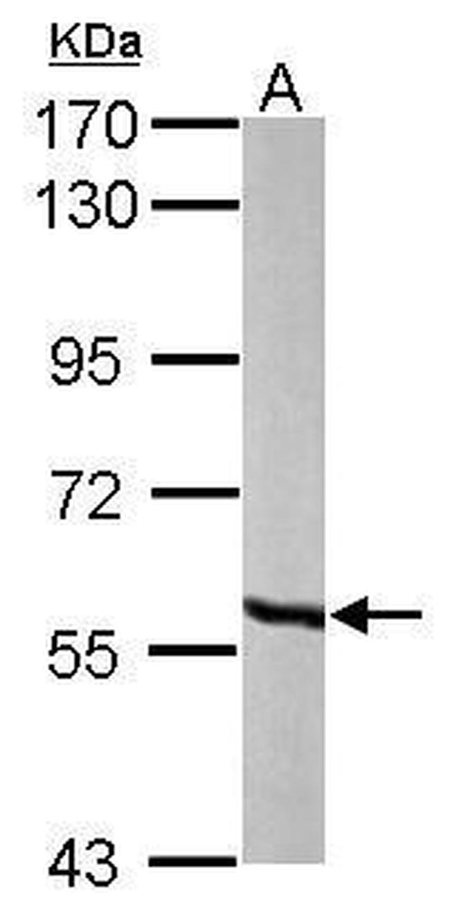 MCCC2 Antibody in Western Blot (WB)