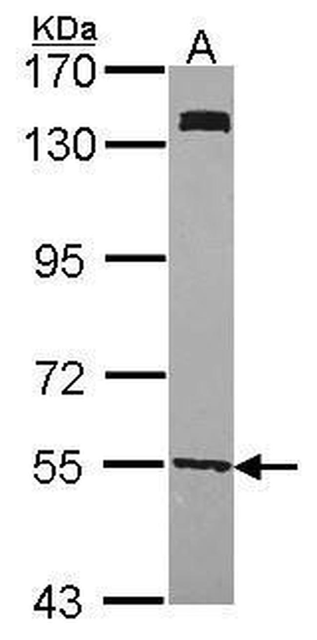 UGP2 Antibody in Western Blot (WB)