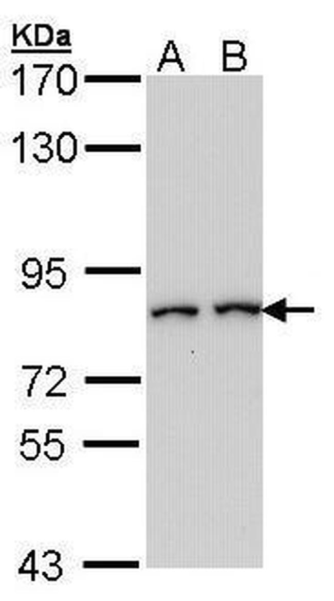 FAP Antibody in Western Blot (WB)