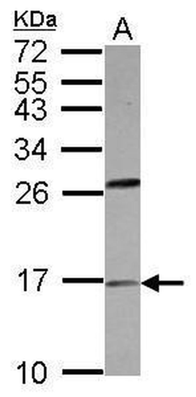 PLA2 Antibody in Western Blot (WB)