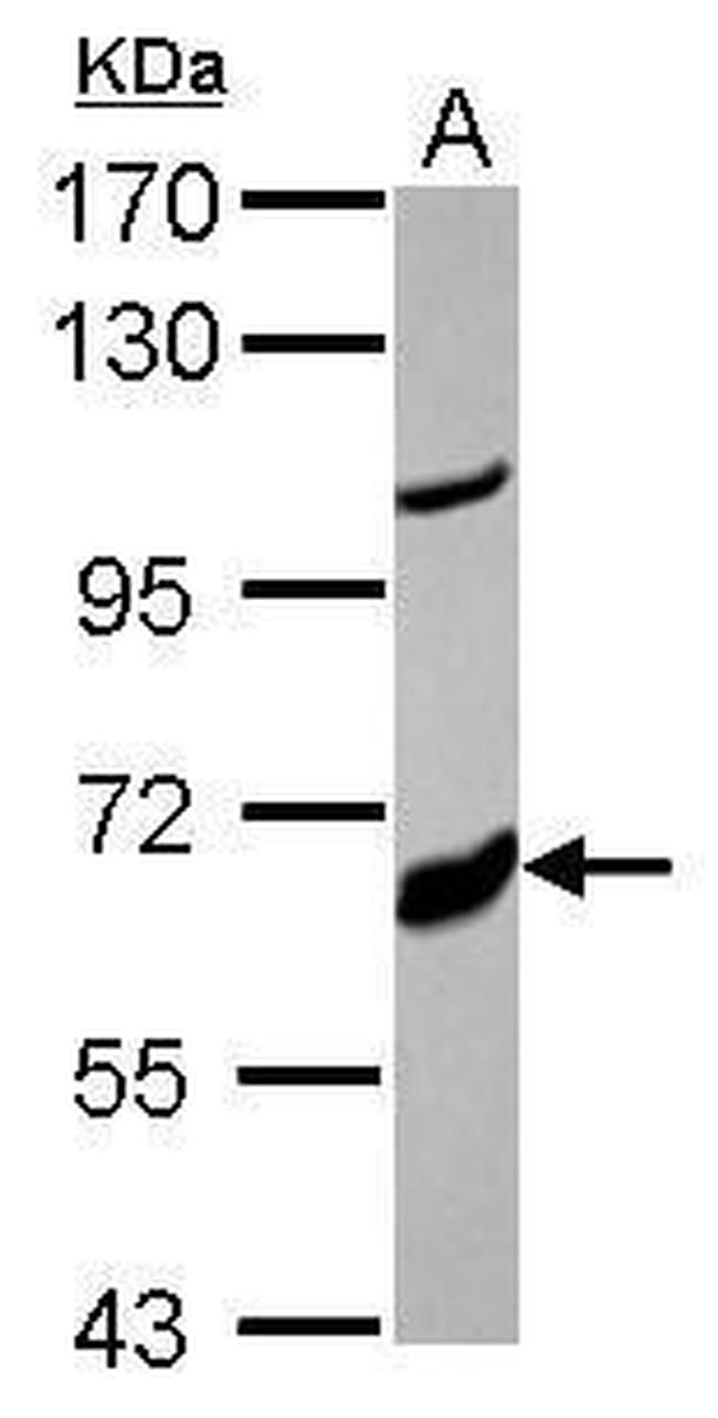 CYP17A1 Antibody in Western Blot (WB)