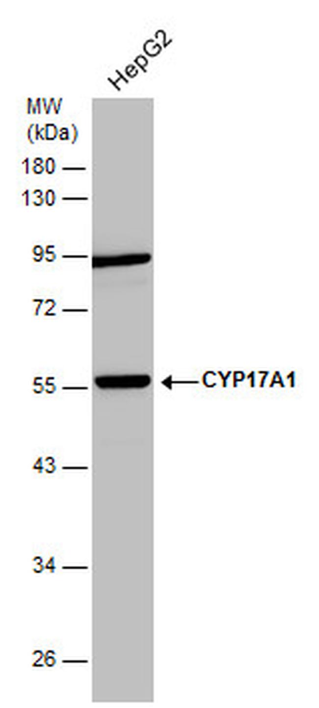 CYP17A1 Antibody in Western Blot (WB)