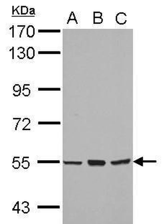 CYP4B1 Antibody in Western Blot (WB)