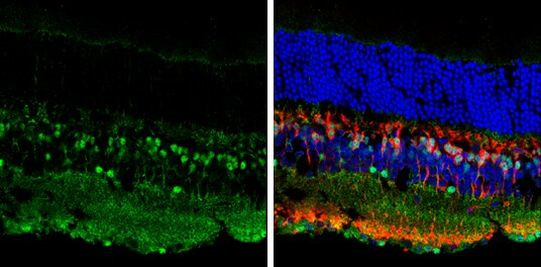 ISL1 Antibody in Immunohistochemistry (Frozen) (IHC (F))