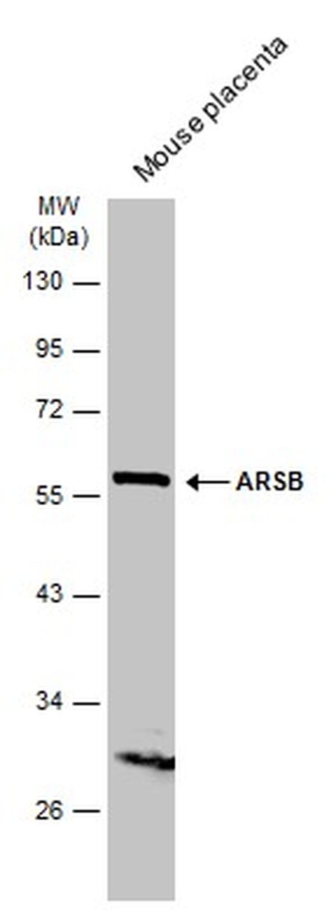 Arylsulfatase B Antibody in Western Blot (WB)