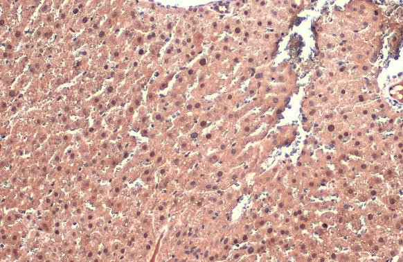 AF9 Antibody in Immunohistochemistry (Paraffin) (IHC (P))