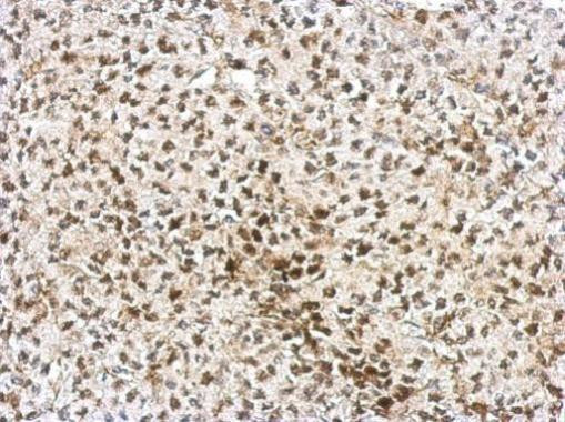 AF9 Antibody in Immunohistochemistry (Paraffin) (IHC (P))