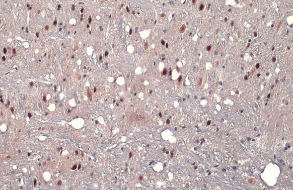 AF9 Antibody in Immunohistochemistry (Paraffin) (IHC (P))