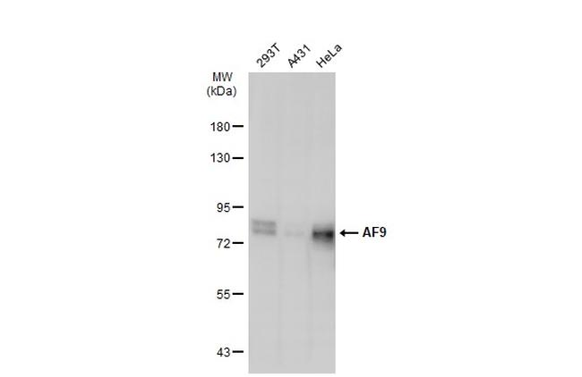 AF9 Antibody in Western Blot (WB)