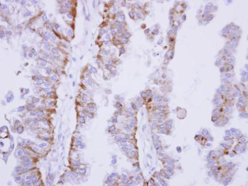 SHP-1 Antibody in Immunohistochemistry (Paraffin) (IHC (P))