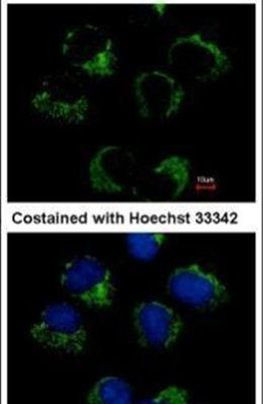 CAT1 Antibody in Immunocytochemistry (ICC/IF)