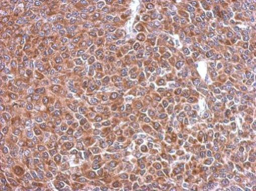 STIP1 Antibody in Immunohistochemistry (Paraffin) (IHC (P))