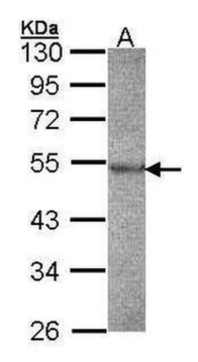 Cathepsin F Antibody in Western Blot (WB)