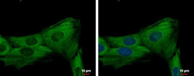 JNK3 Antibody in Immunocytochemistry (ICC/IF)