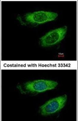 p70 S6 Kinase Antibody in Immunocytochemistry (ICC/IF)