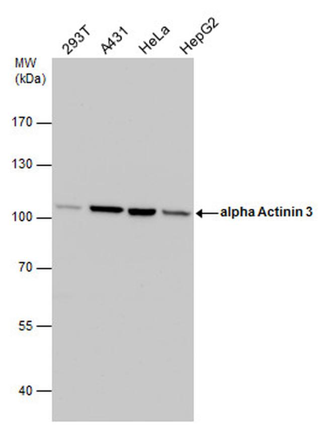 alpha Actinin 3 Antibody in Western Blot (WB)