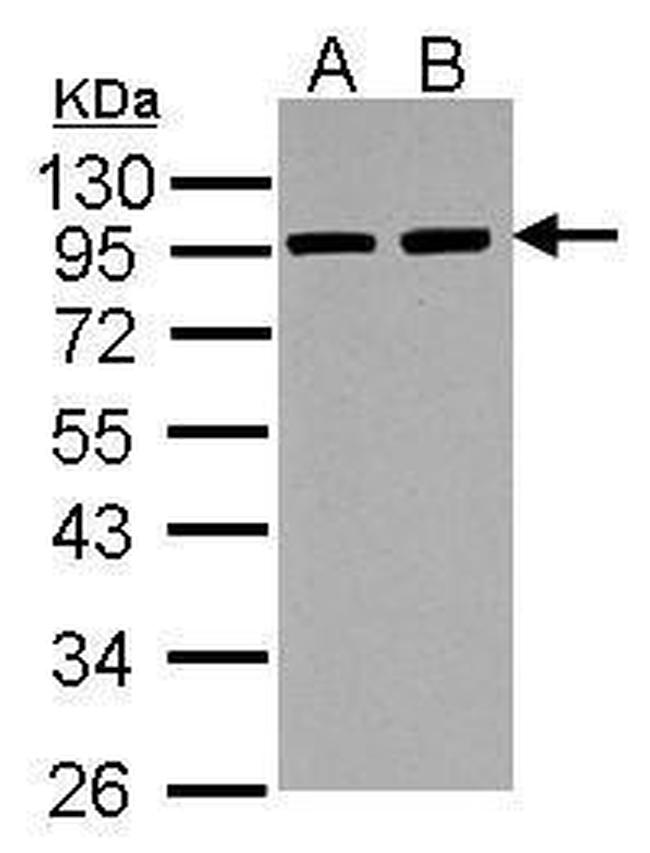 alpha Actinin 3 Antibody in Western Blot (WB)