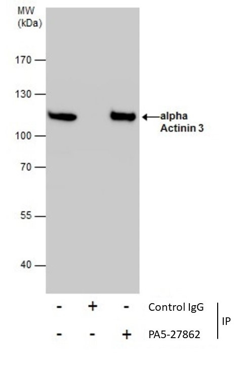 alpha Actinin 3 Antibody in Immunoprecipitation (IP)