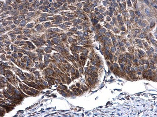 TFAM Antibody in Immunohistochemistry (Paraffin) (IHC (P))