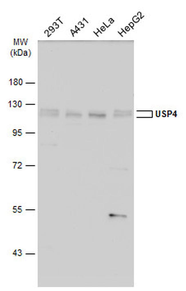 USP4 Antibody in Western Blot (WB)