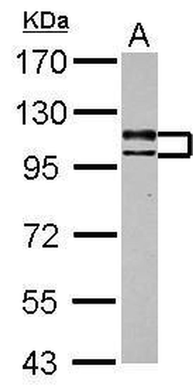 USP4 Antibody in Western Blot (WB)