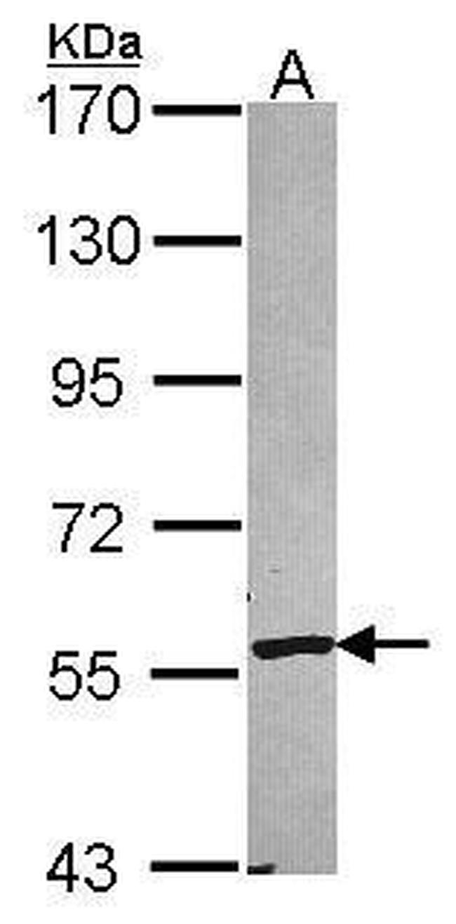 CYP2A6 Antibody in Western Blot (WB)