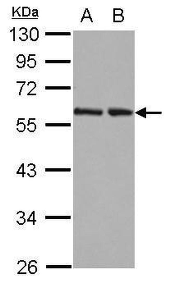 RAD23B Polyclonal Antibody (PA5-27902)