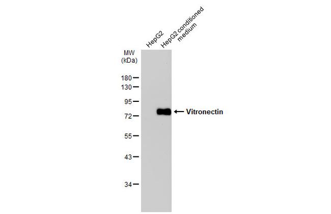 Vitronectin Antibody in Western Blot (WB)