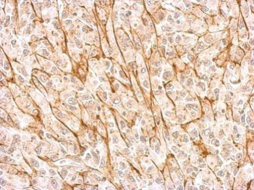 NMDAR2A Antibody in Immunohistochemistry (Paraffin) (IHC (P))