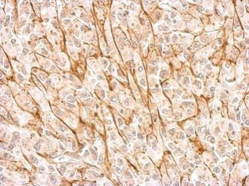 NMDAR2A Antibody in Immunohistochemistry (Paraffin) (IHC (P))