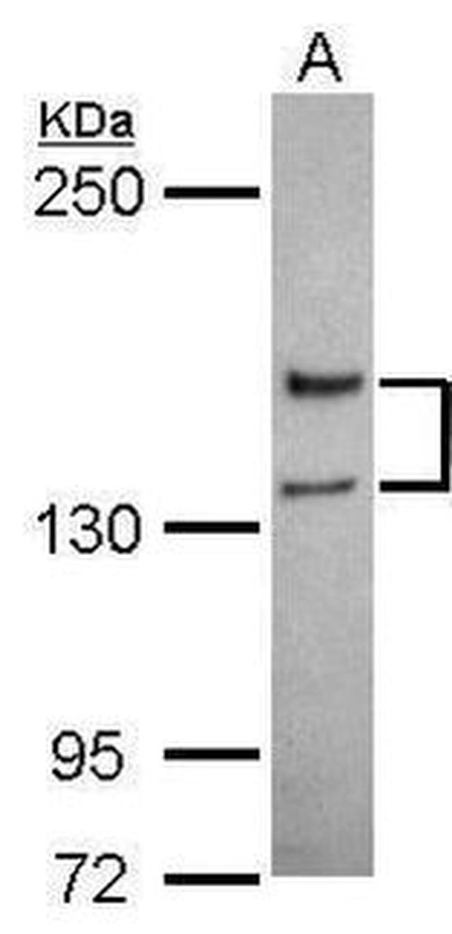 NMDAR2A Antibody in Western Blot (WB)