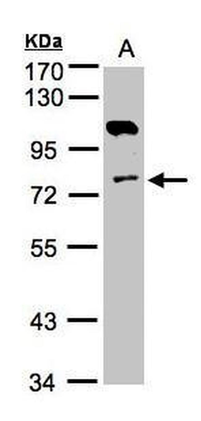 Adenylate Kinase 7 Antibody in Western Blot (WB)