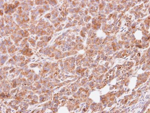 GNAI3 Antibody in Immunohistochemistry (Paraffin) (IHC (P))