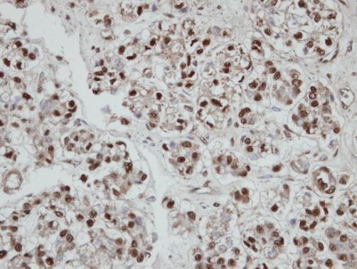 SEPHS2 Antibody in Immunohistochemistry (Paraffin) (IHC (P))