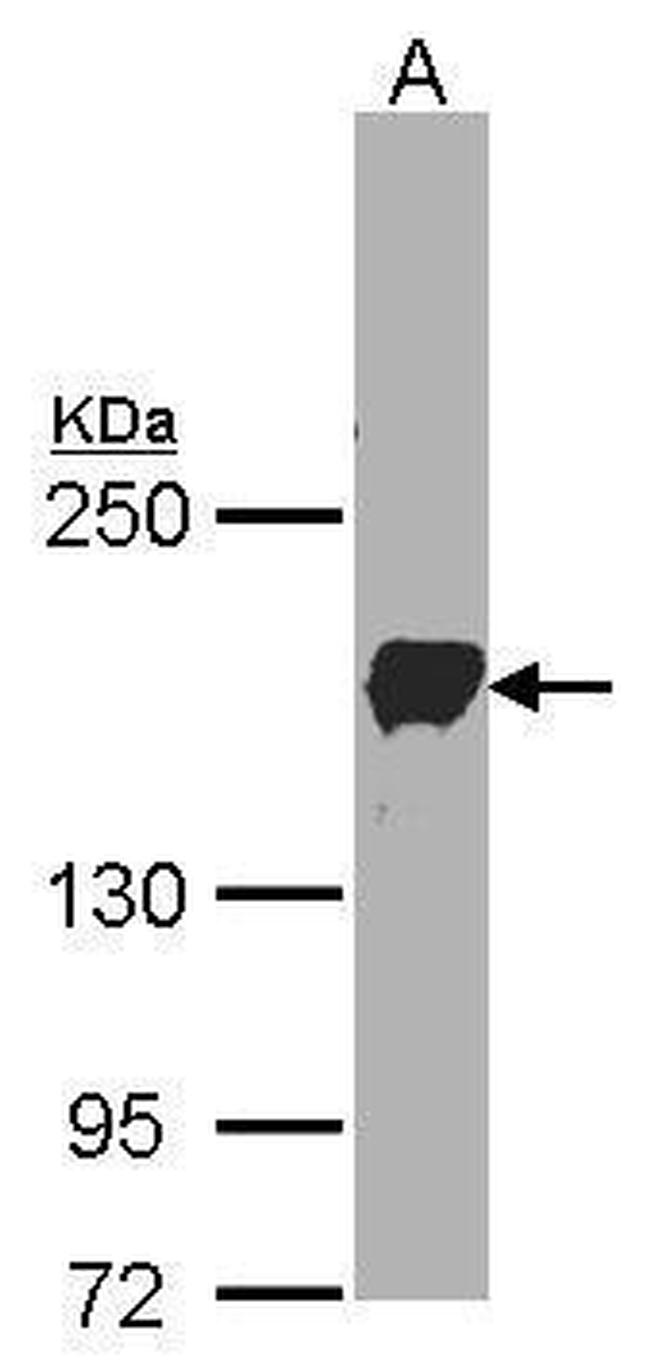 PCDH1 Antibody in Western Blot (WB)