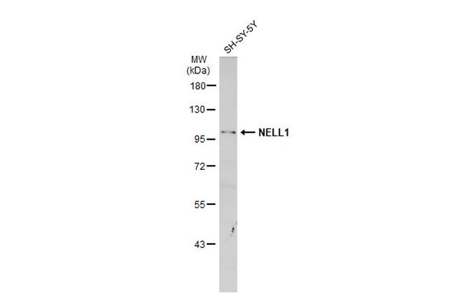 NELL1 Antibody in Western Blot (WB)