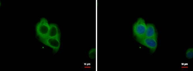 MOX1 Antibody in Immunocytochemistry (ICC/IF)